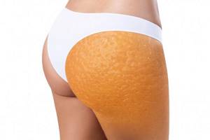 anti-cellulite massage orange peel