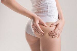 cellulite for skinny people