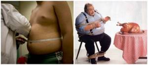 Photos of the consequences of excess weight 2