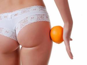 How to get rid of hormonal cellulite