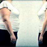 which doctor treats obesity in women