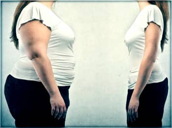 which doctor treats obesity in women