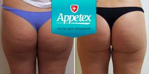 Капли для похудения Appetex