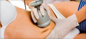 cavitation of the abdomen from cellulite