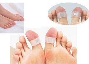 Slimming toe rings
