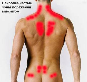 Back muscles anatomy