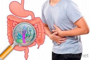 Disturbance of intestinal microflora