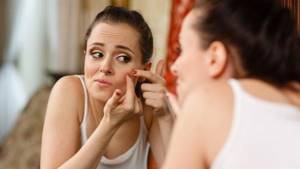 what causes pimples and blackheads on the face