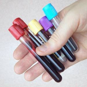 First negative blood group: advantages and disadvantages, diet