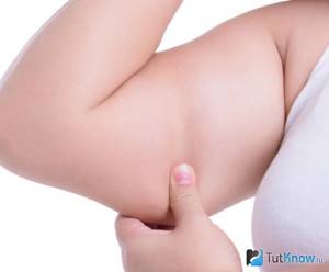 Subcutaneous fat in a girl