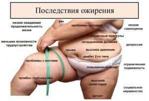 Consequences of obesity