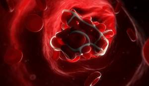 Increased rate of blood clotting