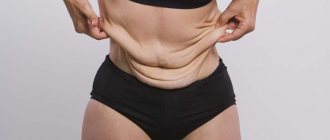 Причины появления обвисшего живота после похудения