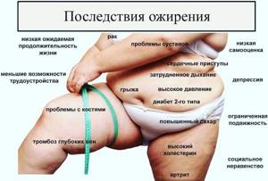 Психосоматика лишнего веса у женщин, мужчин. Как лечить: Луиза Хей, Дмитрий Троцкий