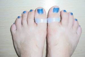 Do toe magnets really help you lose weight?