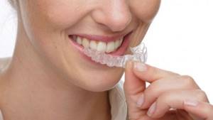 сколько стоит отбелить зубы у стоматолога
