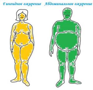 Types of obesity