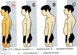 Exercises for straight posture in the gym and at home