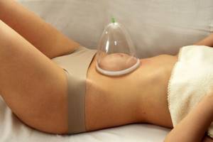 Vacuum to the rescue: cupping massage