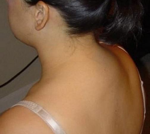 Collar area of ​​the back