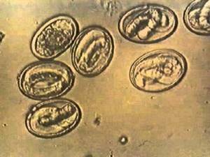 Roundworm eggs under a microscope