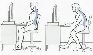 exercise to correct posture