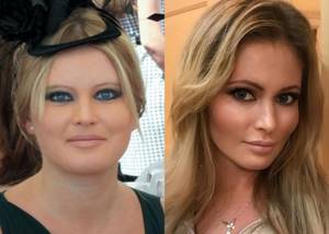 No fat (and no cheeks): faces of Russian stars after losing weight - Dana Borisova